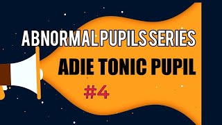 ADIE TONIC PUPIL  DIAGNOSIS AND TREATMENT OF ADIE TONIC PUPIL  Abnormal pupil series  4 [upl. by Nalyk]