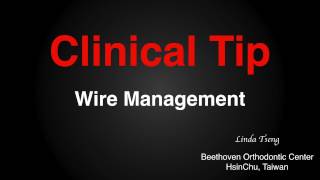 Clinical Tip Wire Management｜CC417 [upl. by Adiell]