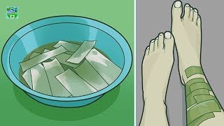 Soak Paper In Apple Cider Vinegar Then Wrap Your Body  Home Remedies [upl. by Riddle]