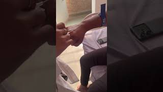 Canula insertion technique  hospital injection doctor youtubeshorts trending viralvideo [upl. by Trahern]