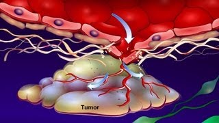 Introduction to Cancer Biology Part 4 Angiogenesis [upl. by Debera]