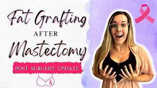 The Honest Truth About How My Breast Reconstruction and Fat Grafting Surgery Went  Post Op Update [upl. by Arimahs]