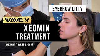 Getting a NonSurgical Eyebrow Lift with Injections Influencer tries Xeomin after YEARS of Botox [upl. by Niehaus952]