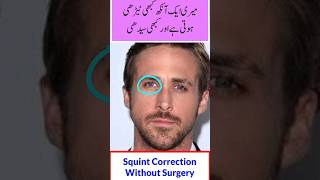 Fix your squint with exercise  Bhengapan ka ilaj [upl. by Erodeht]