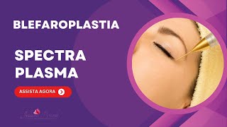 BLAFAROPLASTIA SEM CORTE COM SPECTRA PLASMA  JATO DE PLASMA [upl. by Sarine60]