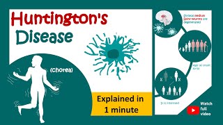 Huntingtons disease in 1 minute  1 minute pathology  Huntingtons chorea [upl. by Aitropal829]