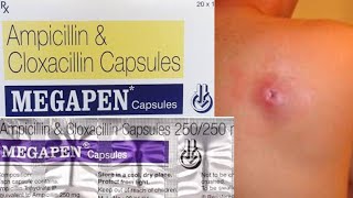 Megapen 500 mg capsules uses in telugu Ampicillin and cloxacillin uses in telugu [upl. by Ganley]