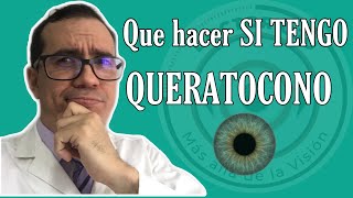 👀 👁 Que hacer si tengo QUERATOCONO en los OJOS 2020 ✌🏼👊 👨🏻‍⚕️ [upl. by Macey]