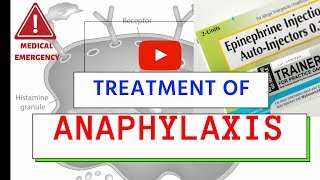 Treatment of Anaphylaxis  Medical Emergency  Must Know [upl. by Tiebout]