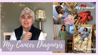 My Cancer Diagnosis Cancer at 21 [upl. by Einej623]