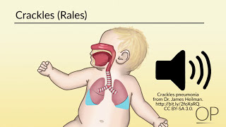 Respiratory Assessment by B Leary L DelSignore  OPENPediatrics [upl. by Bax]