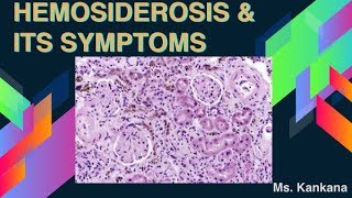 What are Hemosiderosis and its symptoms Biotechnology  General Medicine [upl. by Olwena]