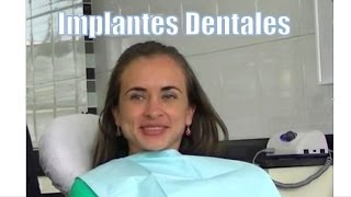 Testimonio de jovencita con Implantes Dentales frontales  Odontologia Estetica en Bogota [upl. by Akehsay]