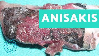 Lista de pescados con Anisakis  CONSEJOS DE SALUD [upl. by Sorel]