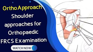 OrthoApproach  Shoulder approaches for Orthopaedic FRCS Examination [upl. by Peedsaj]