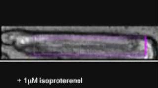 cardiac myocyte contractility [upl. by Eenaej]