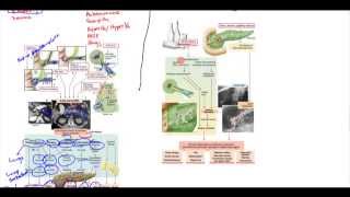 Acute Pancreatitis Chronic Pancreatitis Psuedocyst Adenocarcinoma [upl. by Acsicnarf]