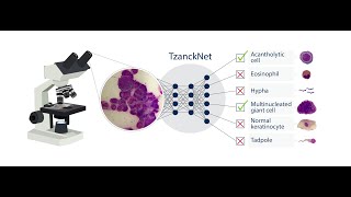 TzanckNet A novel deep learning tool for dermatologists [upl. by Anaic354]