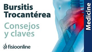 Trocanteritis o bursitis trocantérea claves para entenderla [upl. by Anitnatsnoc]