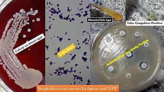 Staphylococcus aureus golden yellow colonies Gram stain Coagulase test Growth on MSA and AST [upl. by Anirdnajela591]