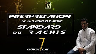 QUICK EP 1  INTERPRÉTATION DUNE RX ST DU RACHIS [upl. by Hentrich]