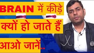 दिमागी कीड़ा कैसे बनता है  सिर में कीड़े के लक्षण  Neurocysticercosis treatment in hindi [upl. by Tayyebeb]