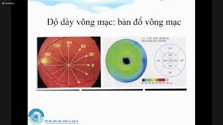 OCT VÀ CÁC BỆNH LÍ DỊCH KÍNH  VÕNG MẠC NGOẠI KHOA [upl. by Dammahum774]