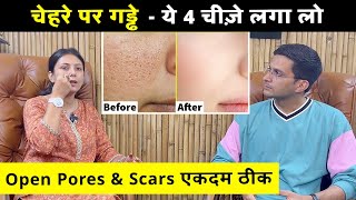 Open Pores And Scars Treatment Ftupasanakiduniya  Open Pores Home Remedy  Himanshu Bhatt [upl. by Hugh]