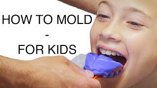 HOW TO MOLD a MOUTHGUARD Custom for KIDS  PROCHOCS [upl. by Pengelly935]