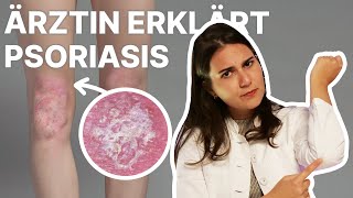 Ist SchuppenflechtePsoriasis nur trockene Haut 🤔 Ärztin erklärt [upl. by Stanislaus]