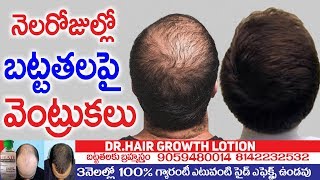 నెల రోజుల్లో బట్ట తలపై వెంట్రుకలు  Hair Fall Control In 30 Days  DR Hair Growth Lotion  TNN [upl. by Lassiter]