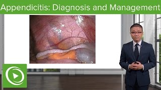 Appendicitis Diagnosis and Management – General Surgery  Lecturio [upl. by Aicilat]