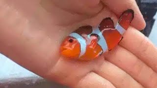 15 Most Poisonous Fish in the World [upl. by Mozza435]