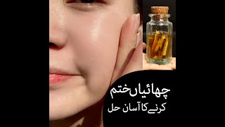 How to freckles treatment at home  چھائیاں ختم کرنے کا آسان حل [upl. by Leibrag]