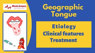 Geographic tongue Benign Migratory Glossitis [upl. by Bartholomeo623]