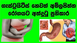 ලාබම ගැස්ට්‍රයිටීස් බෙහෙත  Gastritis in 5 minutes  How to get rid of gastritis completely [upl. by Eatnad]