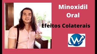 MINOXIDIL ORAL X EFEITOS COLATERAIS  Bate Papo com a Dra Renata Vasconcellos [upl. by Chickie56]