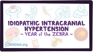 Idiopathic intracranial hypertension Year of the Zebra [upl. by Goulden]