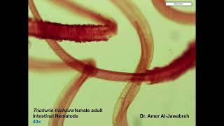 Trichuris trichiura Adult Female Intestinal Nematode [upl. by Merrilee956]