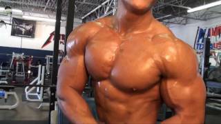 Andrew Vu 5 weeks out [upl. by Arved]