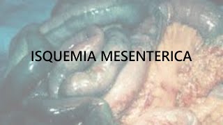 ISQUEMIA MESENTERICA AGUDA [upl. by Anpas846]