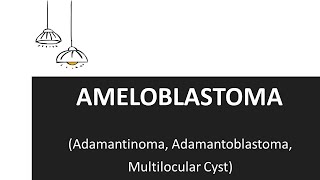 Ameloblastoma  Clinical Features and Treatment of Ameloblastoma [upl. by Sosthena]