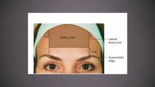 Chapter 1Botox injections in forehead [upl. by Aillil]