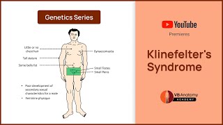 Klinefelters Syndrome Explained Genetics Characteristics and Complications [upl. by Odnalref]