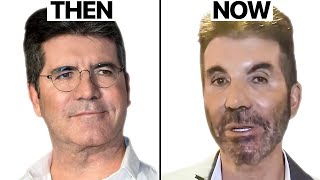 Simon Cowell NEW FACE  Plastic Surgery Analysis [upl. by Esidarap]