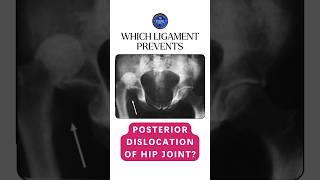 Which ligament prevents the posterior dislocation of hip joint shorts hipjoint ligaments [upl. by Amye]