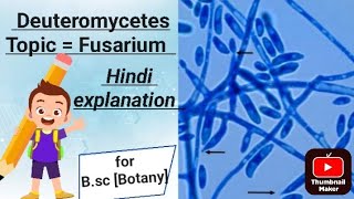 Topic  Fusarium  for Bsc Botany [upl. by Anassor]