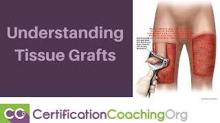 Understanding Tissue Grafts [upl. by Ahtreb]