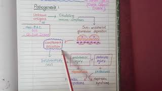 Membranoproliferative Glomerulonephritis  Pathology [upl. by Anelleh]