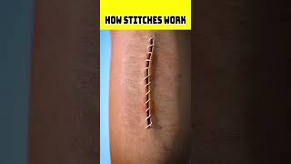 How Stitches Work shorts viral youtubeshorts ytshorts [upl. by Ahsin514]